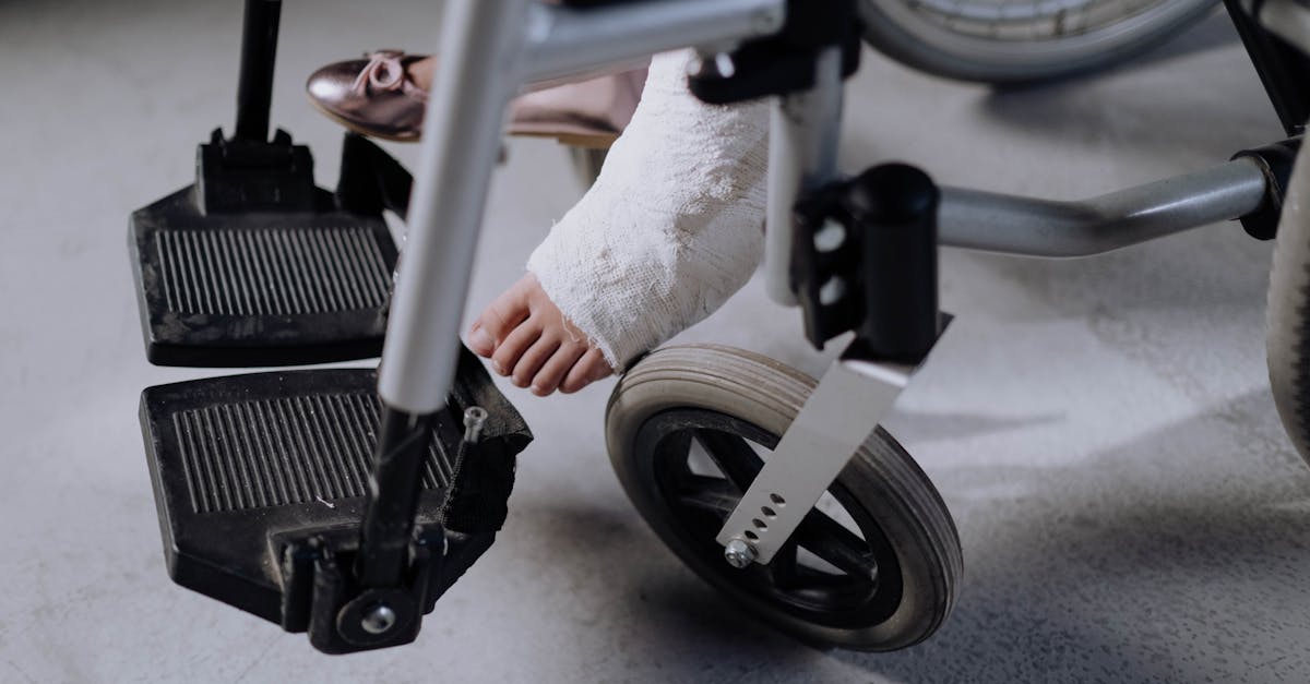 close up of an injured foot in a cast resting on a wheelchair indoors